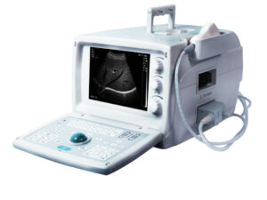 Máy Siêu Âm Đen Trắng U620